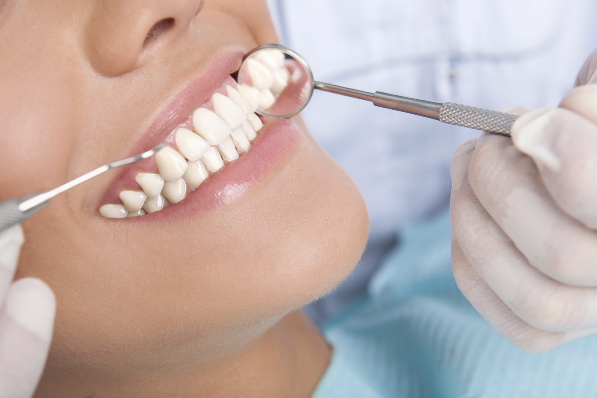 Close-up of a woman sitting in dental office while doctor examines her porcelain inlays and onlays.