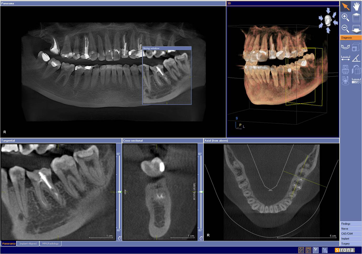 3D xrays of a patient's mouth