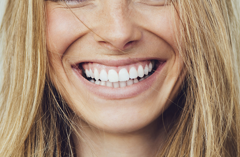 Portrait of young woman with beautiful smile and Cerec teeth.
